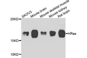 Western blot analysis of extracts of various cell lines, using HRAS antibody (ABIN5975854) at 1/1000 dilution.