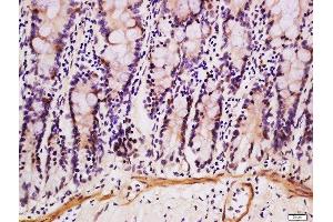 Formalin-fixed and paraffin embedded mouse intestine labeled with Anti-DEFB124 Polyclonal Antibody, Unconjugated  at 1:200 followed by conjugation to the secondary antibody and DAB staining