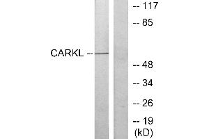 Immunohistochemistry analysis of paraffin-embedded human liver carcinoma tissue using CARKL antibody.