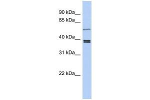 SS18L1 antibody used at 1 ug/ml to detect target protein.