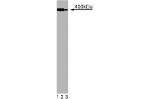 Western blot analysis of Utrophin on a mouse neonate lysate.