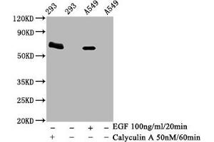 Western Blot Positive WB detected in 293 whole cell lysate 65549 whole cell lysate(treated with Calyculin A or EGF) All lanes Phospho-PRKAA2 antibody at 1. (Recombinant PRKAA2 antibody  (pThr172))