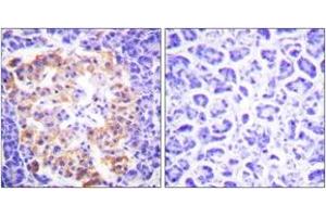 Immunohistochemistry analysis of paraffin-embedded human pancreas tissue, using Collagen III Antibody.