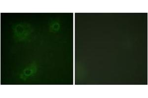 Immunofluorescence analysis of COS7 cells, using IRS-1 (Ab-323) Antibody. (IRS1 antibody  (AA 289-338))