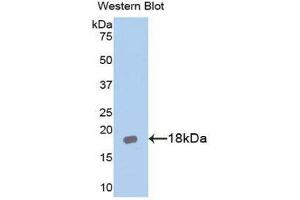 Western Blotting (WB) image for anti-Interleukin 18 Receptor Accessory Protein (IL18RAP) (AA 396-548) antibody (ABIN1174895) (IL18RAP antibody  (AA 396-548))