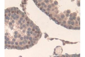 Immunohistochemistry (IHC) image for anti-Interleukin 17 Receptor D (IL17RD) (AA 356-605) antibody (ABIN7443272)