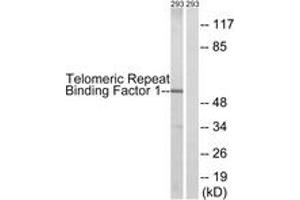 Western blot analysis of extracts from 293 cells, treated with Paclitaxel 1uM 24h, using Telomeric Repeat Binding Factor 1 (Ab-219) Antibody. (TRF1 antibody  (AA 185-234))