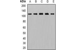 Western blot analysis of AP2-alpha-1 expression in THP1 (A), Hela (B), mouse brain (C), rat liver (D), rat lung (E) whole cell lysates. (alpha Adaptin antibody)