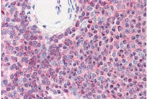 Human Spleen (formalin-fixed, paraffin-embedded) stained with CFL1 antibody ABIN364365 at 10 ug/ml followed by biotinylated anti-mouse IgG secondary antibody ABIN481714, alkaline phosphatase-streptavidin and chromogen. (Cofilin antibody  (AA 1-166))