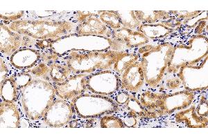 Immunohistochemistry (IHC) image for anti-Leukemia Inhibitory Factor Receptor alpha (LIFR) (AA 522-691) antibody (ABIN7437668)