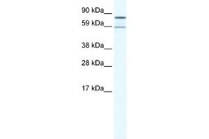 WB Suggested Anti-PARN Antibody Titration:  1. (PARN antibody  (N-Term))