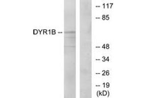 Western blot analysis of extracts from Jurkat cells, using DYR1B Antibody. (DYRK1B antibody  (AA 331-380))
