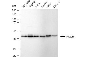 Western blotting analysis using PAWR antibody (ABIN7799899). (Recombinant PAWR antibody)
