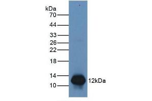 Figure. (S100A8 antibody  (AA 1-93))