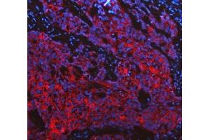 IF analysis of Cytokeratin 19 using anti-Cytokeratin 19 antibody (ABIN3043288). (Cytokeratin 19 antibody  (C-Term))