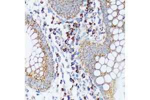 Immunohistochemistry of paraffin-embedded human appendix using Sprouty 2 Rabbit mAb (ABIN7270554) at dilution of 1:100 (40x lens). (SPRY2 antibody)