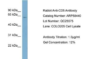 WB Suggested Anti-CD5  Antibody Titration: 0. (CD5 antibody  (N-Term))