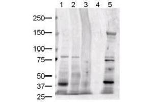 Image no. 3 for anti-Jagged 1 (JAG1) (AA 110-125) antibody (ABIN226630) (JAG1 antibody  (AA 110-125))
