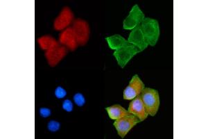 ABIN6265052 and ABIN6272430 staining Hela cells(30 min of UV treatment) by IF/ICC. (SH3BGR antibody  (Internal Region))