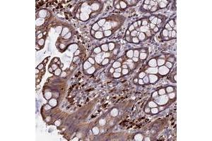 Immunohistochemical staining of human rectum with RLTPR polyclonal antibody  shows moderate cytoplasmic positivity in glandular cells at 1:50-1:200 dilution. (RLTPR antibody)
