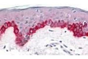 Immunohistochemistry of Apaf1 in human skin tissue with Apaf1 (CT) antibody at 20 μg/ml. (APAF1 antibody  (C-Term))
