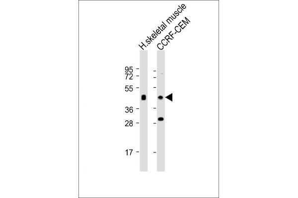 SLC16A10 Antikörper  (C-Term)