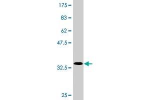 Western Blot detection against Immunogen (33. (SLC25A23 antibody  (AA 2-74))