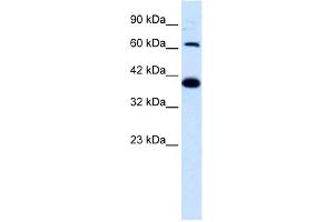 WB Suggested Anti-GRIK2 Antibody Titration:  1.