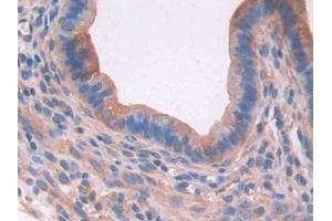 Detection of PON2 in Mouse Uterus Tissue using Polyclonal Antibody to Paraoxonase 2 (PON2) (PON2 antibody  (AA 4-289))