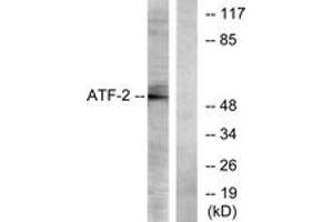 Western blot analysis of extracts from LOVO cells, using ATF2 (Ab-73 or 55) Antibody. (ATF2 antibody  (AA 40-89))