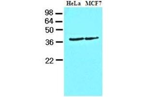 Cell lysates of HeLa and MCF7 (40 ug) were resolved by SDS-PAGE, transferred to nitrocellulose membrane and probed with anti-human Casein Kinase 1 alpha (1:1000).