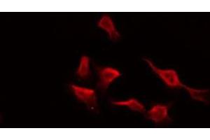 ABIN6275985 staining HepG2 by IF/ICC. (Endothelin-1 Receptor antibody  (C-Term))