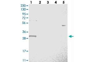 Western blot analysis of Lane 1: RT-4, Lane 2: U-251 MG, Lane 3: Human Plasma, Lane 4: Liver, Lane 5: Tonsil with WBSCR27 polyclonal antibody  at 1:250-1:500 dilution. (WBSCR27 antibody)