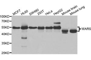 Western blot analysis of extracts of various cell lines, using WARS antibody.