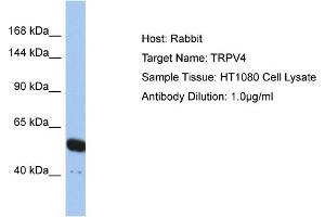 Host: Rabbit Target Name: TRPV4 Sample Type: HT1080 Whole cell lysates Antibody Dilution: 1. (TRPV4 antibody  (N-Term))