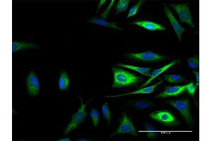 Immunofluorescence of purified MaxPab antibody to CAST on HeLa cell. (Calpastatin antibody  (AA 1-686))