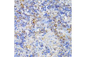 Immunohistochemistry of paraffin-embedded mouse spleen using CAD antibody (ABIN6130029, ABIN6137837, ABIN6137838 and ABIN6224367) at dilution of 1:100 (40x lens).