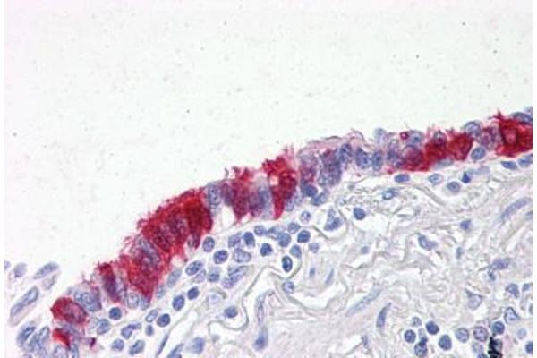 ARVCF antibody  (AA 863-963)