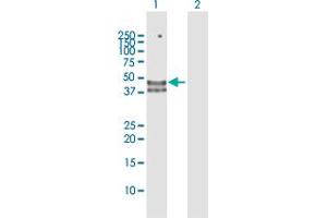 Western Blot analysis of HYAL3 expression in transfected 293T cell line by HYAL3 MaxPab polyclonal antibody. (HYAL3 antibody  (AA 1-417))