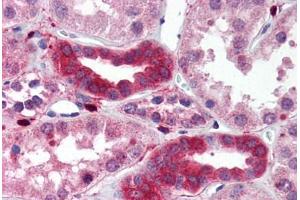 Human Kidney (formalin-fixed, paraffin-embedded) stained with MAP3K7IP1 antibody ABIN214510 at 2. (TAB1 antibody)