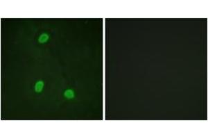 Immunofluorescence analysis of HeLa cells, using NIPA (Ab-354) Antibody. (ZC3HC1 antibody  (AA 320-369))
