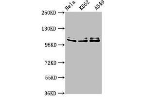Western Blot Positive WB detected in: Hela whole cell lysate, K562 whole cell lysate, A549 whole cell lysate All lanes: XAB2 antibody at 3 μg/mL Secondary Goat polyclonal to rabbit IgG at 1/50000 dilution Predicted band size: 101 kDa Observed band size: 101 kDa