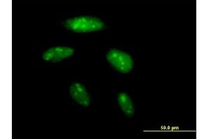 Immunofluorescence of purified MaxPab antibody to BAZ2B on HeLa cell. (BAZ2B antibody  (AA 1-643))