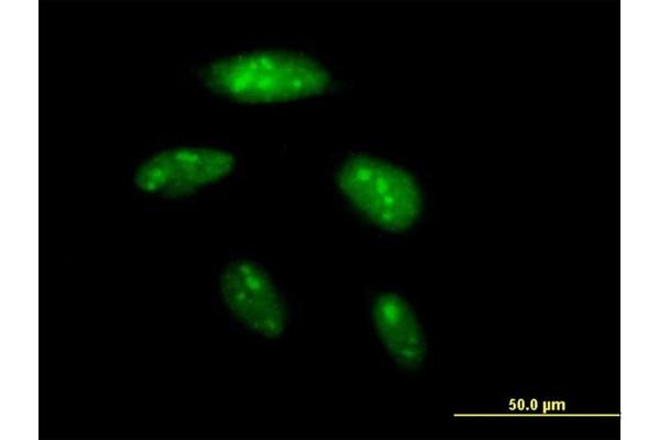 BAZ2B antibody  (AA 1-643)