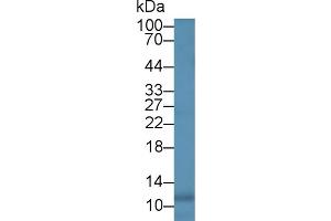 Detection of IL8 in Human Leukocyte lysate using Monoclonal Antibody to Interleukin 8 (IL8) (IL-8 antibody  (AA 23-101))