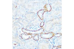 Immunohistochemistry of paraffin-embedded mouse kidney using NDUFV1 Rabbit pAb  at dilution of 1:100 (40x lens). (NDUFV1 antibody  (AA 1-250))