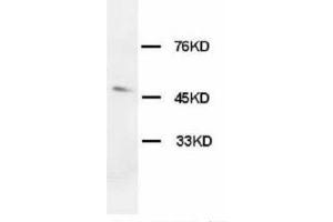 Image no. 2 for anti-Hypocretin (Orexin) Receptor 1 (HCRTR1) (C-Term) antibody (ABIN1492942) (HCRTR1 antibody  (C-Term))