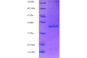 SDS-PAGE (SDS) image for VE6 (AA 1-148), (full length) protein (His-SUMO Tag) (ABIN5710890) (VE6 (AA 1-148), (full length) protein (His-SUMO Tag))