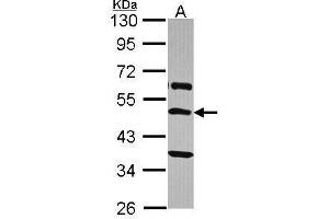 WB Image Sample (30 ug of whole cell lysate) A: A431 , 10% SDS PAGE antibody diluted at 1:2000 (TRHR antibody  (C-Term))