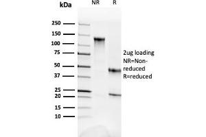 SDS-PAGE Analysis Purified Fodrin Mouse Monoclonal Antibody (SPTAN1/3352). (SPTAN1 antibody  (AA 2351-2475))